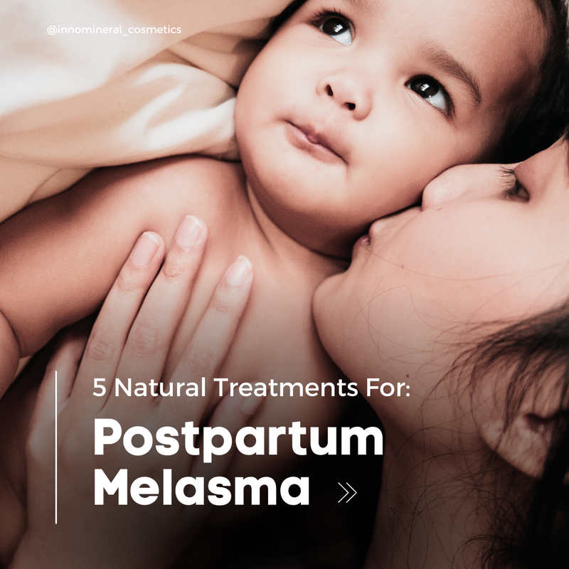 5 Natural Treatments for Postpartum Melasma